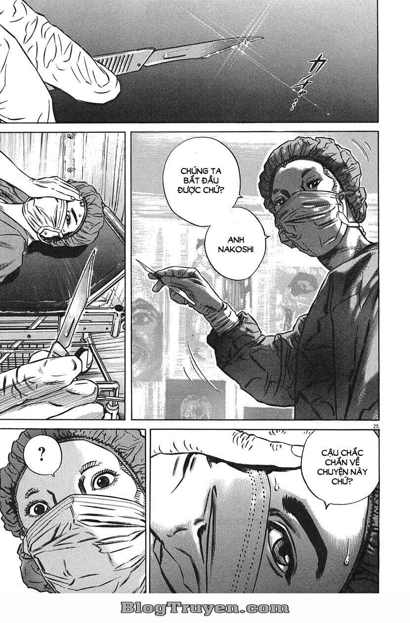 homunculus chapter 63 11