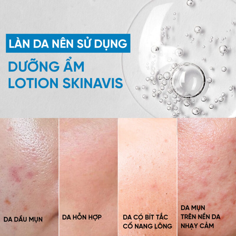 Moisturizer Lotion – Dưỡng ẩm dạng Lotion không nhờn dính 60ml