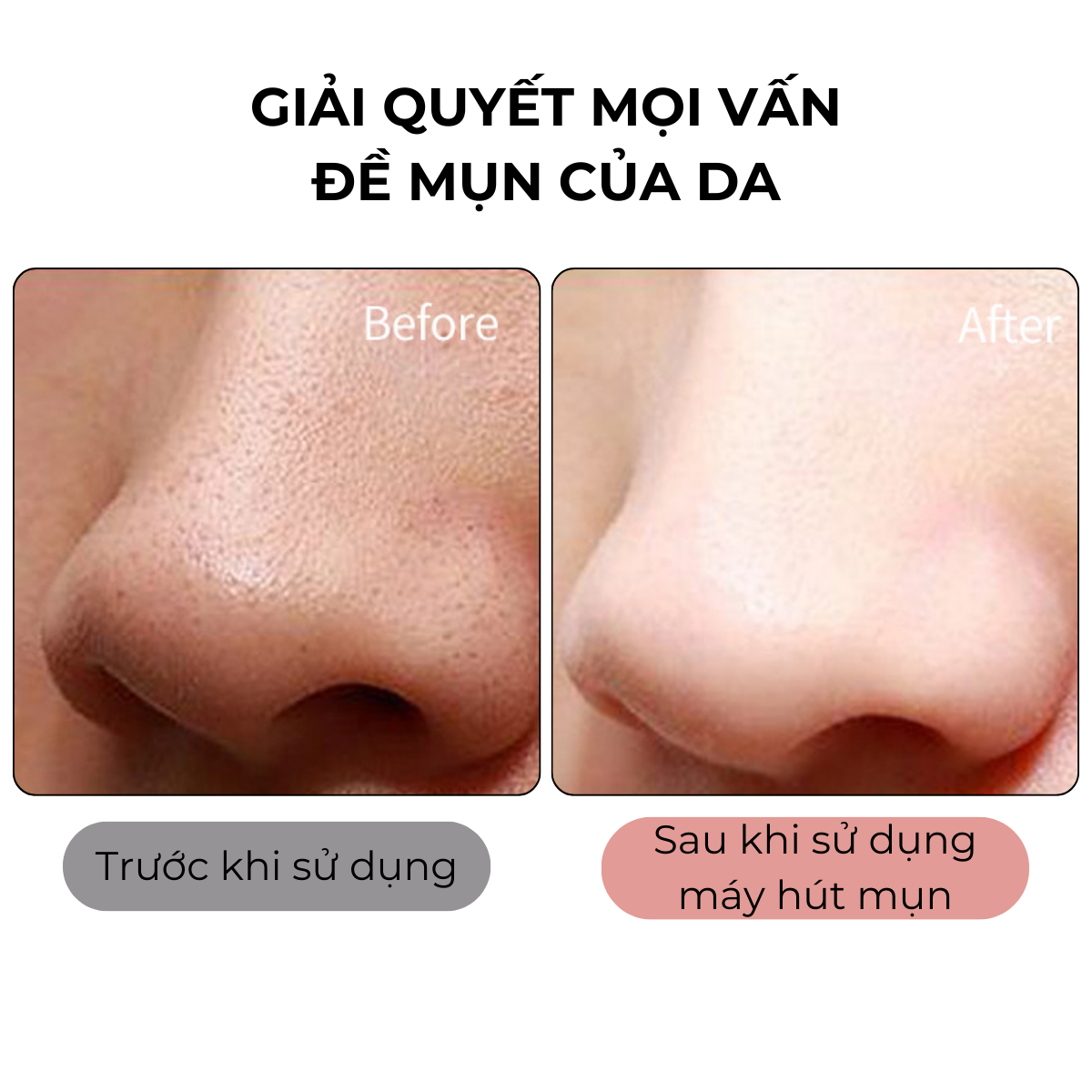 Máy hút mụn cầm tay đa năng Yohiiso cao cấp tích hợp camera soi da, máy hút mụn Spa hút mụn cám sợi bã nhờn, mụn đầu đen an toàn cho da