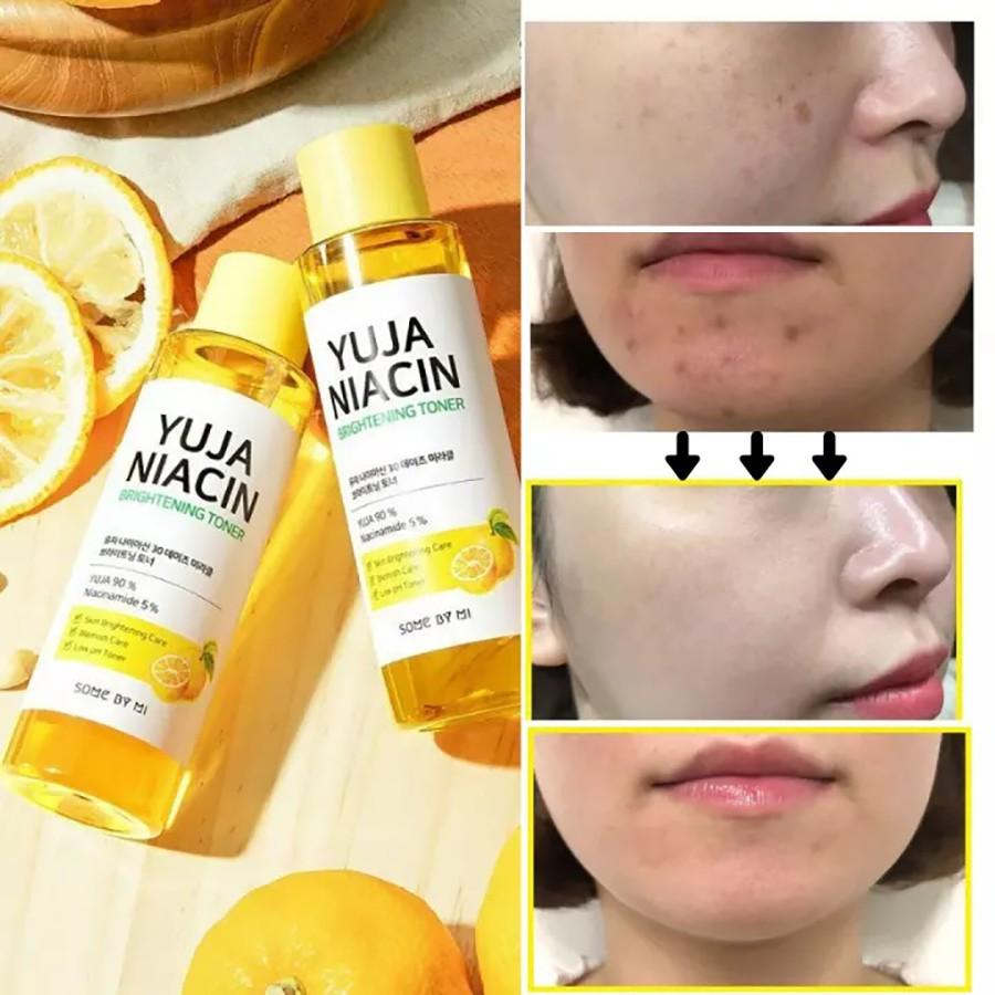 Nước hoa hồng dưỡng trắng da sáng da some by mi yuja niacin 30 days miracle brightening toner 150ml