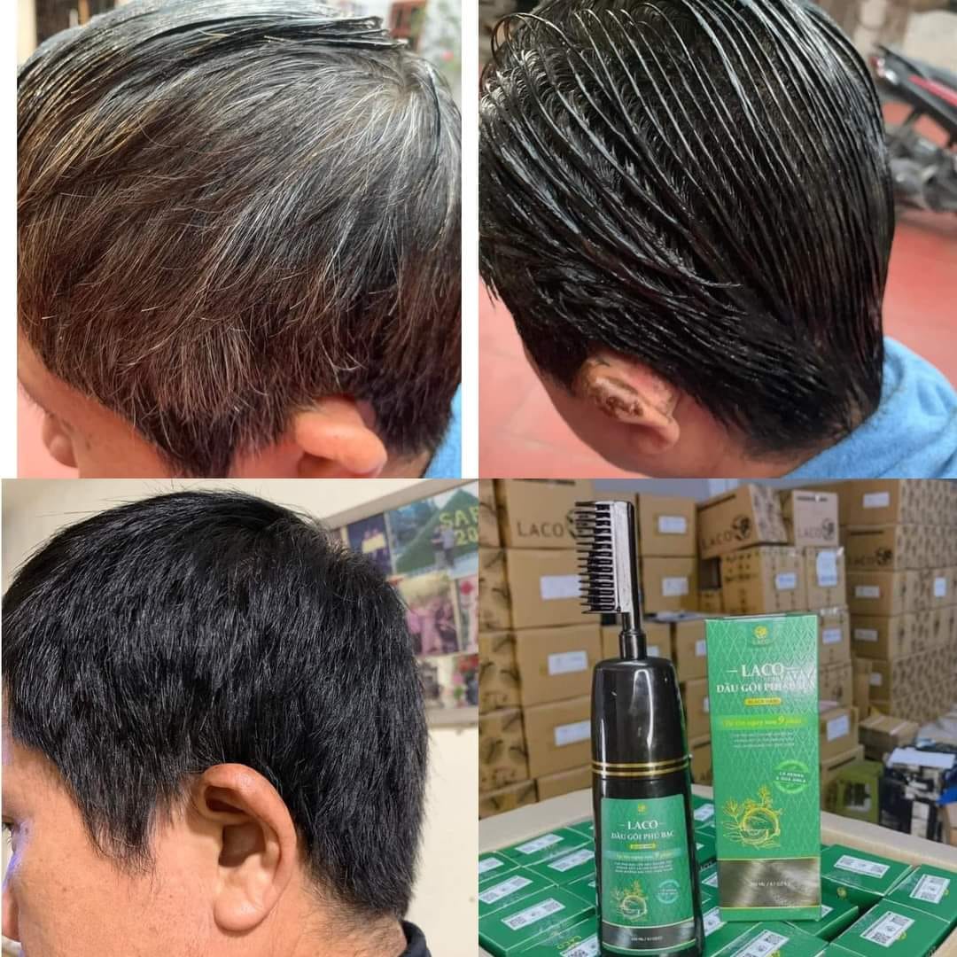 Dầu Gội Phủ Bạc Laco Black Hair - Tóc Đen Tự Tin Sau 9 Phút không phai không sót không hại da đầu mùi thơm chinh hãng sale