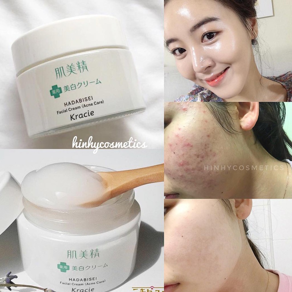 Kem Dưỡng Ẩm Ngăn Ngừa Mụn Kracie Hadabisei Facial Cream Acne Care 50g