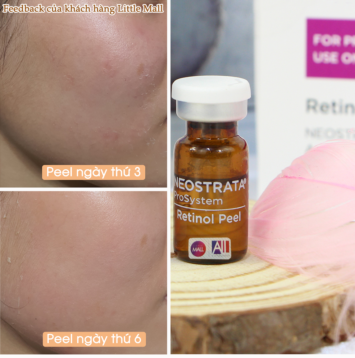 Dung dịch peel sáng da, giảm nhăn Neostrata prosystem 3% retinol peel 1.5ml
