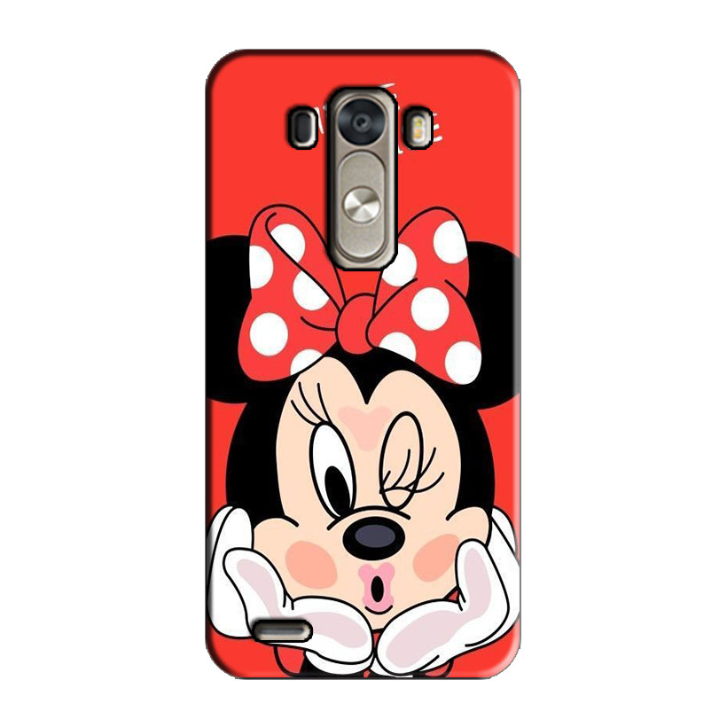 ỐP LƯNG IN DÀNH CHO LG G4