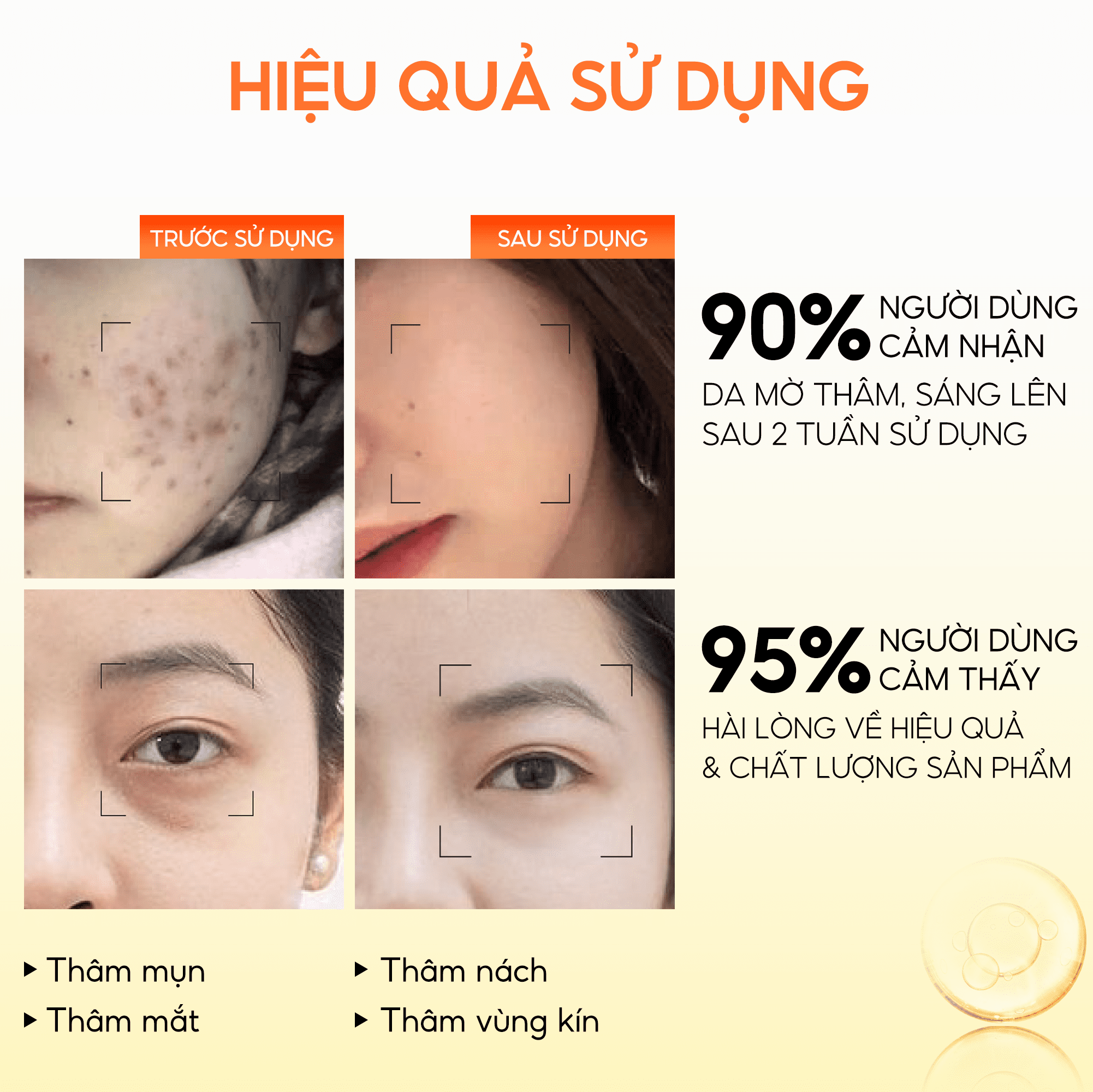 Serum Nghệ Đỏ Nano ABERA - Đánh bật mọi loại thâm