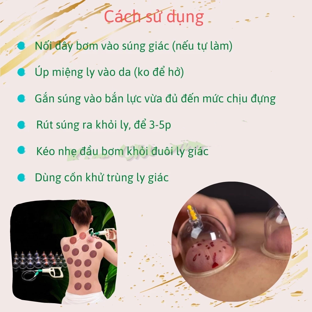 Bộ Giác Hơi Không Dùng Lửa 32/24 Món Cao Cấp, Thiết Bị Giác Hơi Chân Không, Cạo Gió Giác Hơi