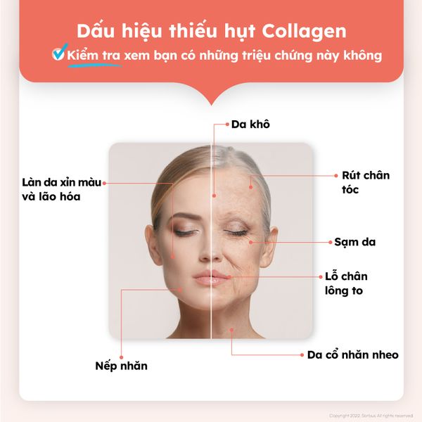 Bột Uống Sorbus Collagen Fish Scale + Vitamin C Cao Cấp Collagen Vảy Cá Cao Cấp, Căng Mịn, Giảm Lão Hóa