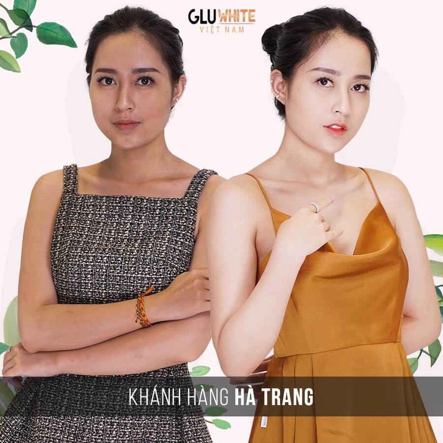 Liệu Trình 3 Hộp Viên Sủi Gluwhite Hỗ Trợ Làm Đẹp Da Mờ Nám