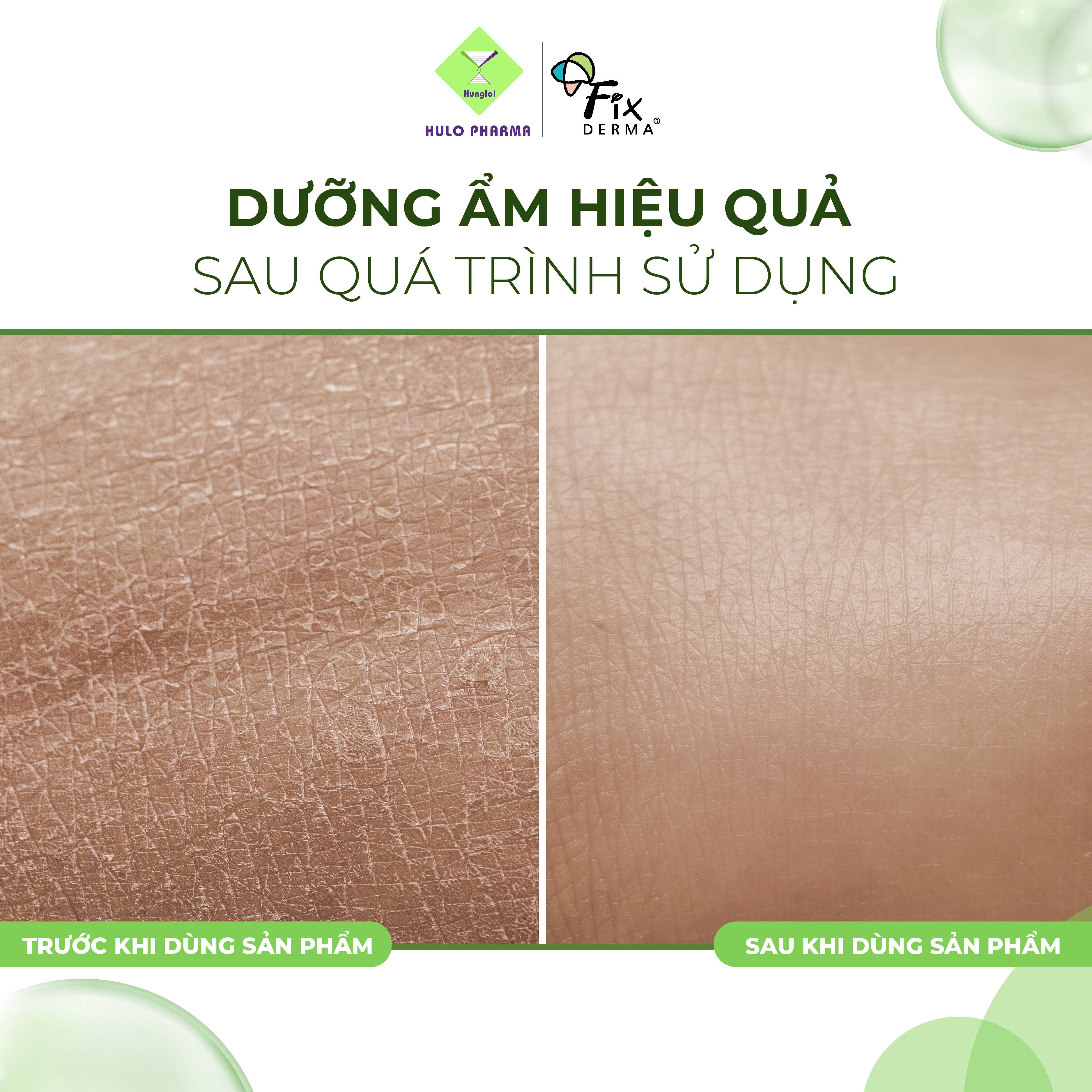 Xà Phòng Tắm Giúp Dưỡng Ẩm FIXDERMA Moisturizing Bar Giúp Dưỡng Trắng Da, Cấp Ẩm, Mềm Mịn Da 100g - Hùng Lợi