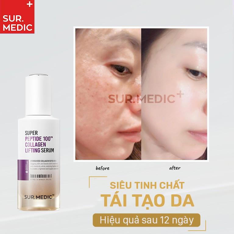 Tinh Chất Trẻ Hoá Da SURMEDIC Super Peptide 100tm Collagen Lifting Serum 50ml