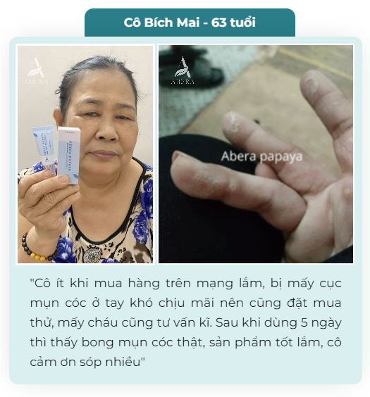 Tinh Chất Đu Đủ Xanh Abera Papaya 7ml - Tinh chất xử lý Mụn Cóc, Mụn Cơm,...