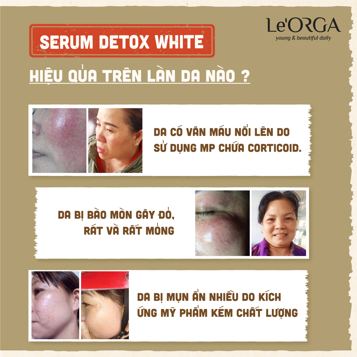 Serum Trắng Da Mờ Nám Le'Orga - Detox White Tinh Chất Trẻ Hóa Da Tăng Độ Ẩm Huyết Thanh Giảm Lão Hóa 7ml