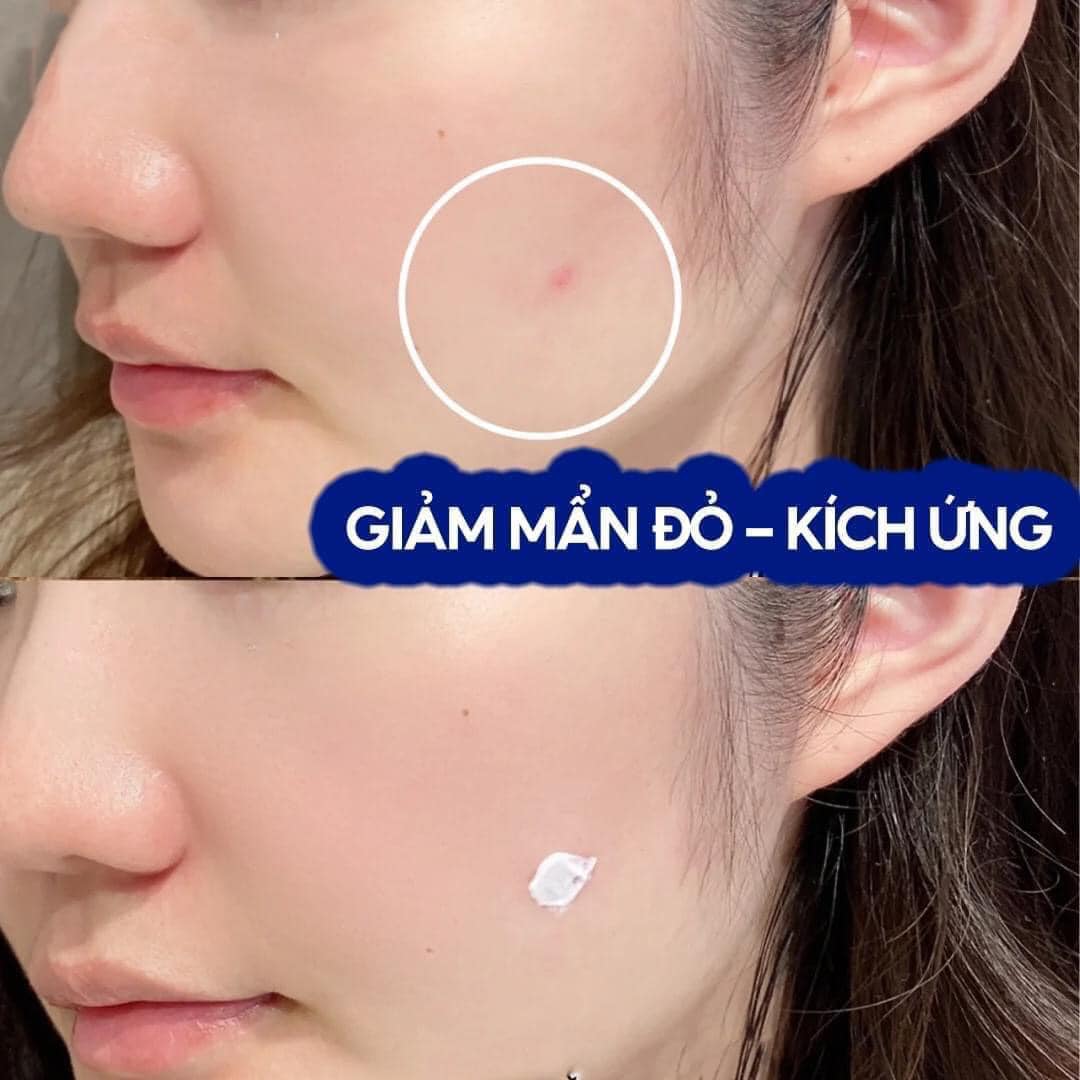 Kem Dưỡng La.Ro.che.Po.say  Cicaplast Baume B5+ Ultra-Repairing Soothing Balm Giúp Phục Hồi Da Đa Công Dụng 100ml ( không xuất hóa đơn đỏ )