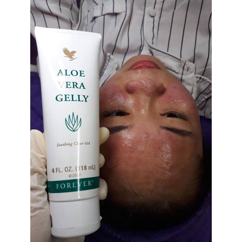 Aloe Vera Gelly Lô Hội, Gel dưỡng da thần thánh FOREVER 061flp, giảm mụn, sẹo . 118ml