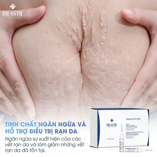 Tinh chất ngăn ngừa và giảm rạn da Rilastil Stretch Marks Ampoules 10 ống x 5ml