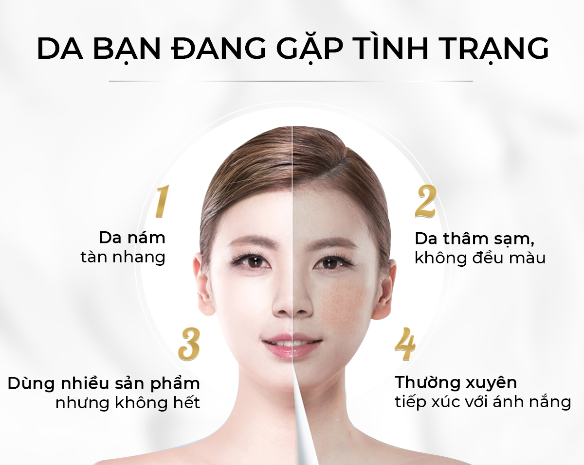 Kem Dưỡng Trắng Da Mờ Nám Tàn Nhang Melasma White Perfect Cream, Giảm Thâm Sạm Sau Mụn, Phù Hợp Với Cả Da Nam Và Nữ