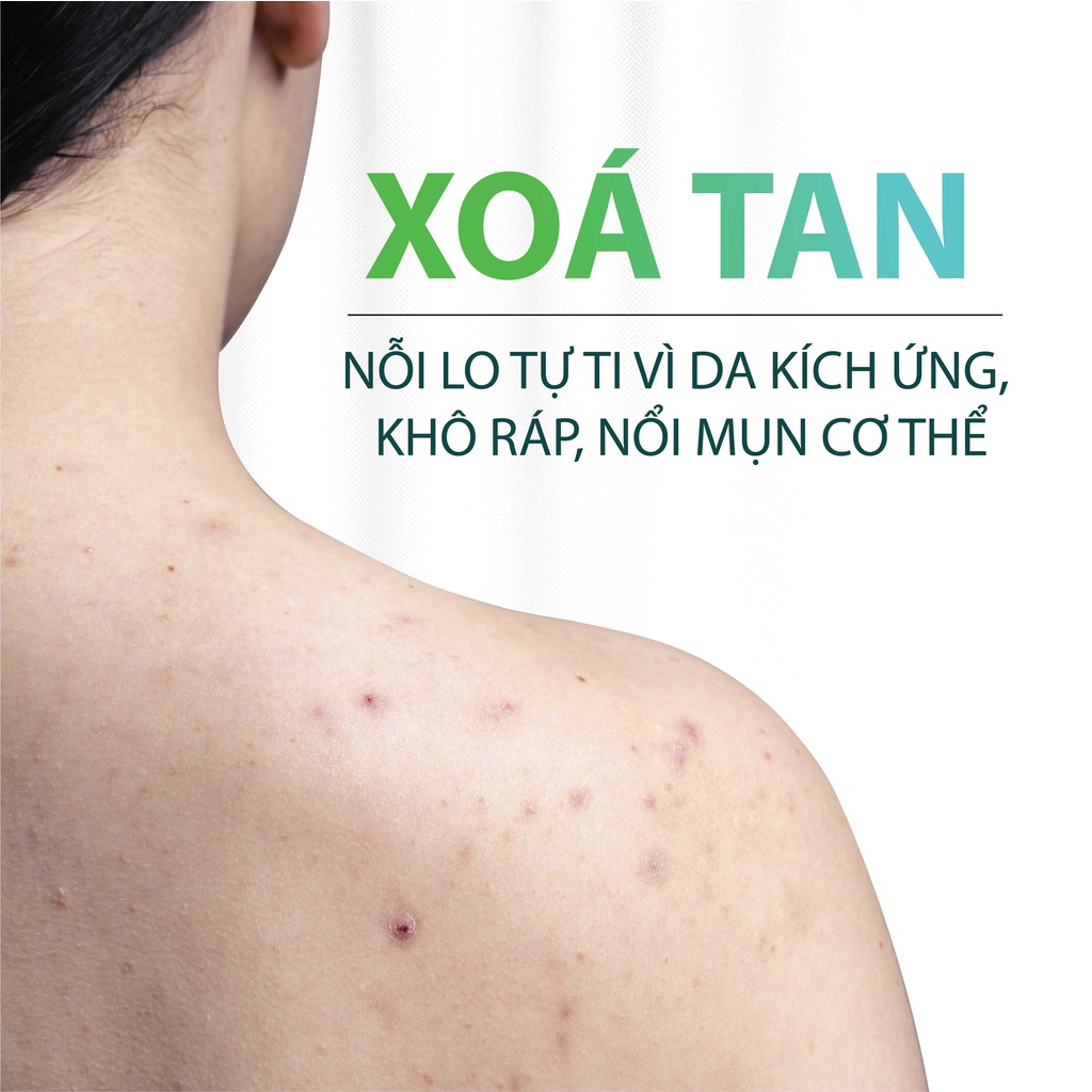 Xà Phòng Tắm Thảo Mộc MILAGANICS Giảm Mụn Lưng, Trắng Da, Mờ Thâm MILAGANICS 100gr - Quà tặng kèm Bông tạo bọt