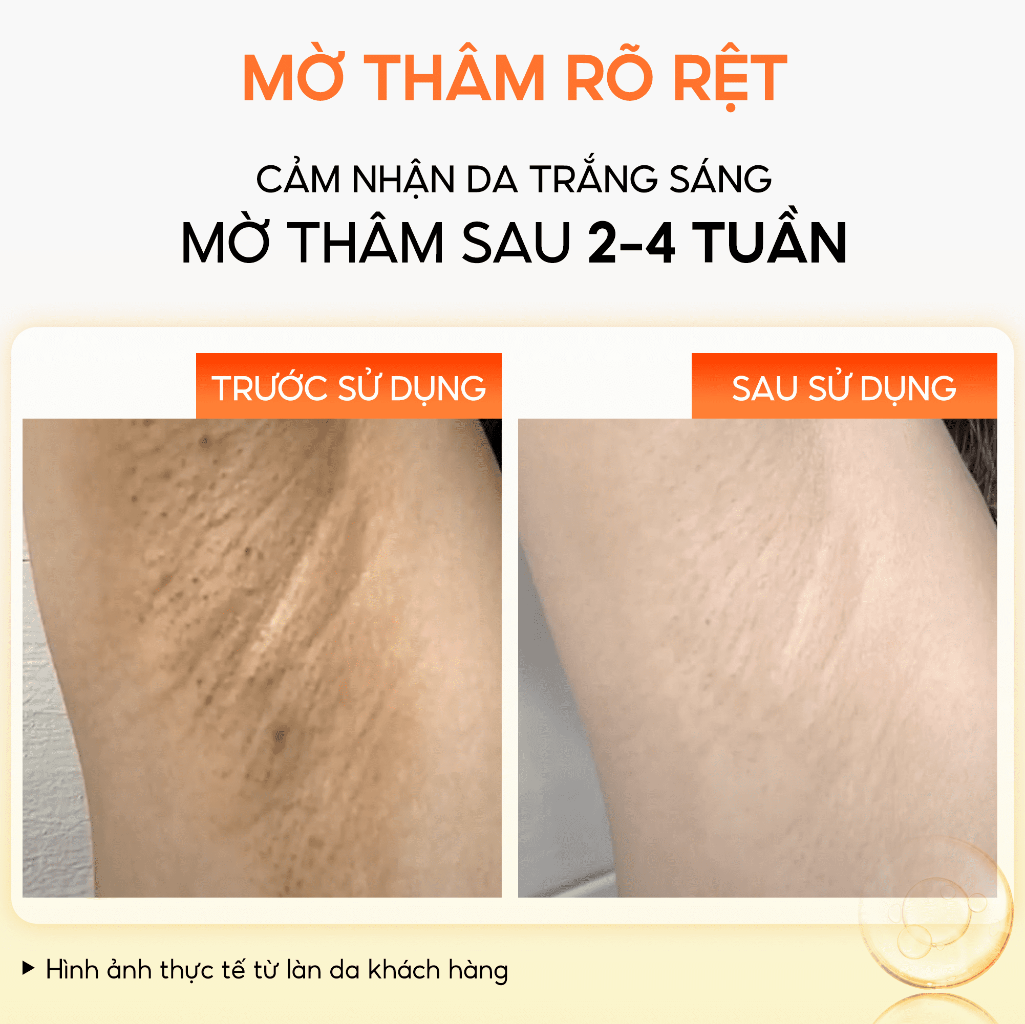 Serum Nghệ Đỏ Nano ABERA - Đánh bật mọi loại thâm