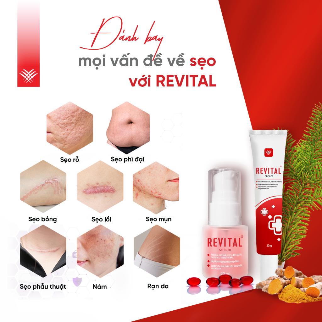 COMBO 3 Tuýp Kem Mờ Sẹo REVITAL 30g, Hỗ Trợ Làm Mờ Sẹo, Giúp Dịu Da Cho Làn Da Sáng Mịn, Hồng Hào