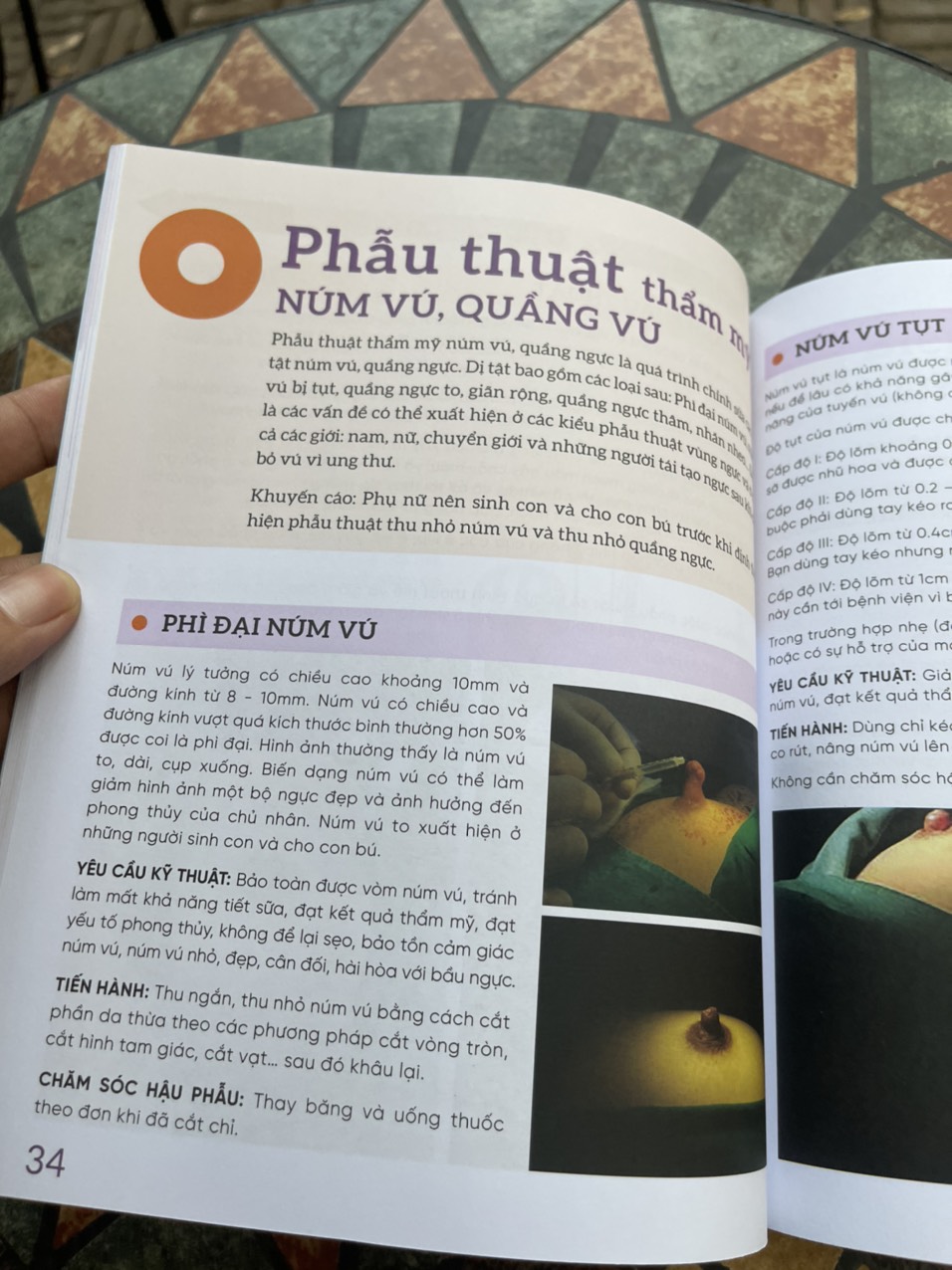 ĐẸP VÀ AN TOÀN TRONG PHẪU THUẬT THẨM MỸ VÙNG NGỰC – Thạc sĩ, bác sĩ Bùi Văn Cường - Con Sóc – Nxb Dân Trí