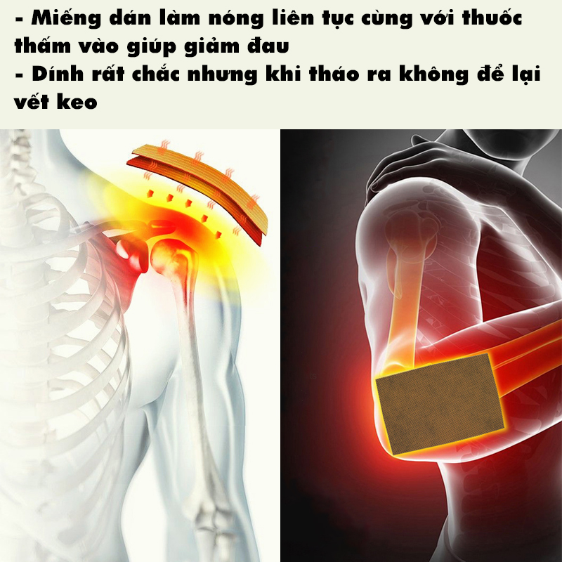 16 Miếng Dán Giảm Đau Mỏi Vai Gáy Lưng Thảo Dược, Cao Dán Massage Nhiệt Và Chai Xịt Giảm Đau 80ml Leagxi