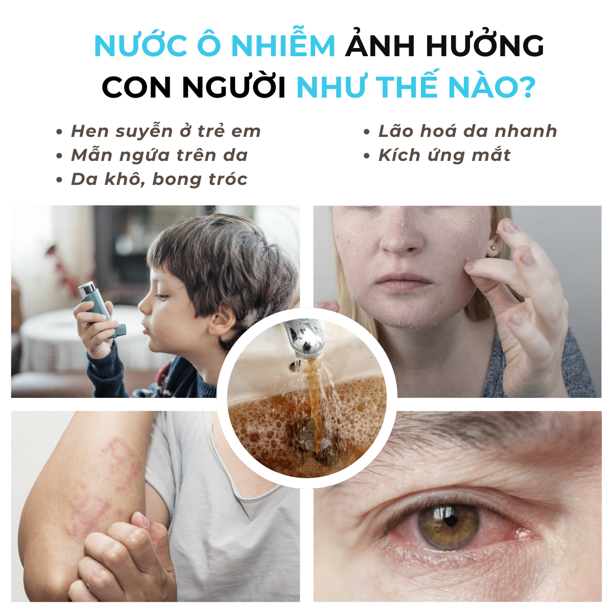 Combo Lõi Lọc Nước, Màng Lọc Thay Thế Cho Đầu Vòi Bồn Rửa Tay, Rửa Chén Daily Aqua - Loại Bỏ Vi Khuẩn