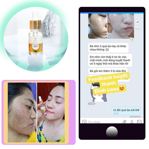 COMBO 3 lọ Huyết Thanh Trắng Da 7 Day - OLIC (Serum 7 DAY - OLIC) giúp TRẮNG DA, NÂNG CƠ, TRẺ HÓA DA, trẻ ra từ 5~10 tuổi. (Tặng 1 sữa rữa mặt sữa chua cao cấp giúp sạch da, sáng da)