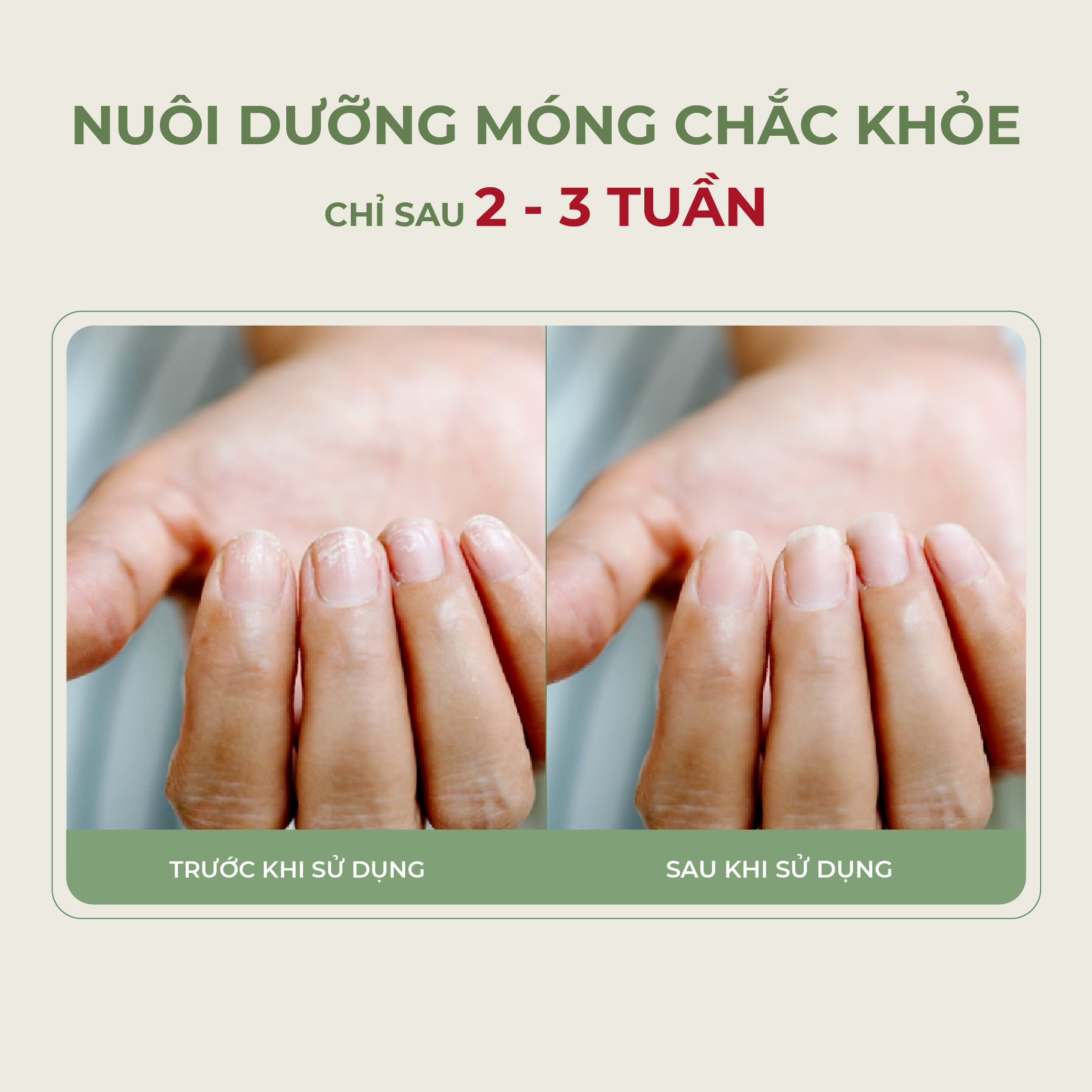 Serum Phục Hồi Móng ABERA Dưỡng Móng NAIL REPAIR Giải Pháp Chăm Sóc Móng Tối Ưu