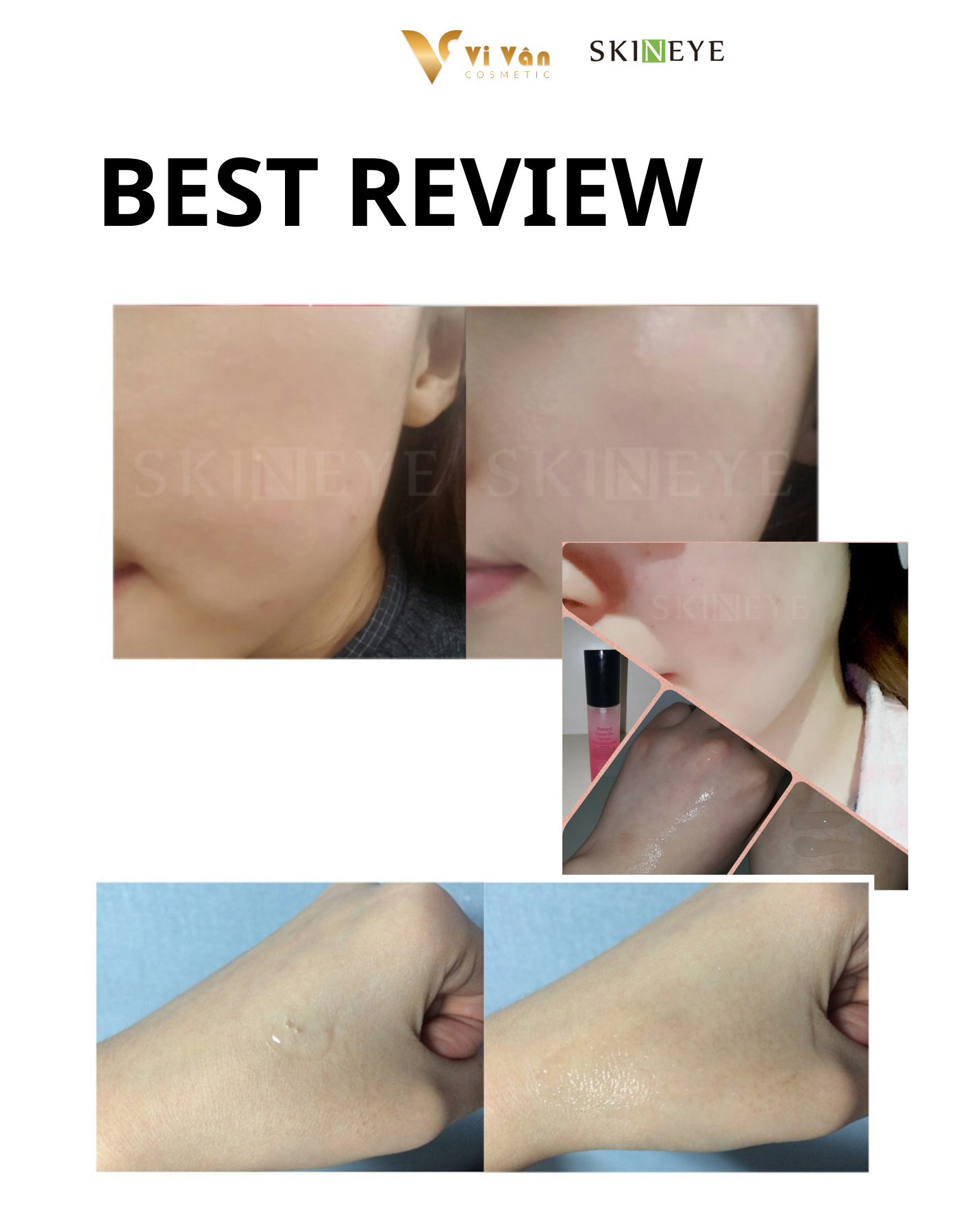 HUYẾT THANH CÂN BẰNG ĐỘ ẨM,CHỐNG LÃO HÓA VÀ TRẮNG DA SKINEYE