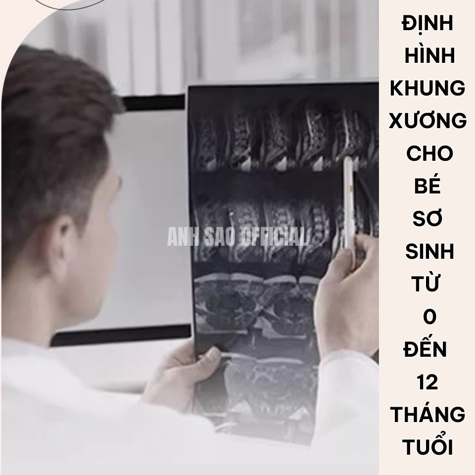 Gối Định Hình Đầu Cho Bé Sơ Sinh Cao Cấp Ánh Sao Chắc Chắn Có Khoá Dán Hỗ Trợ Đầu Cổ Thoáng Khí