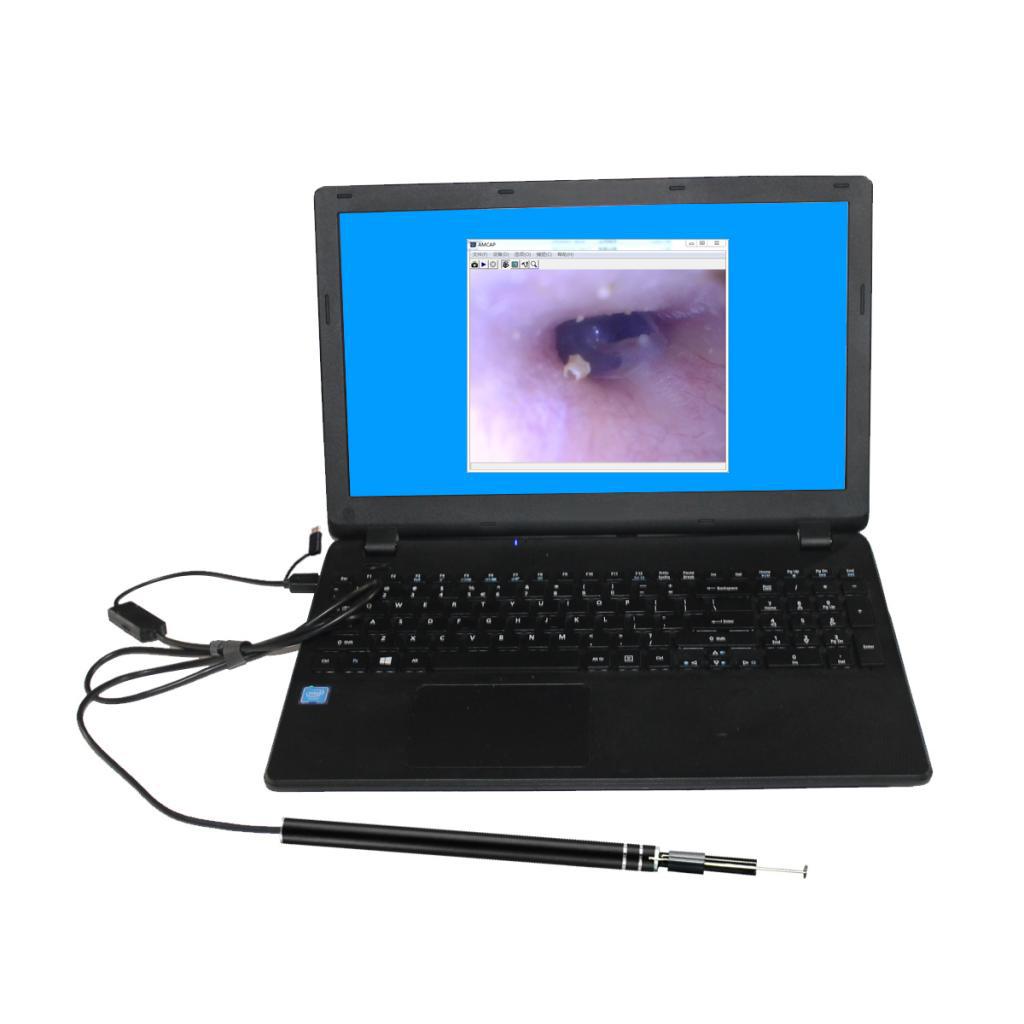 3 In 1 Visual Ear Scoop Ear Borescope 5.5mm Lens 6LED Adjustable Light 1.0MP