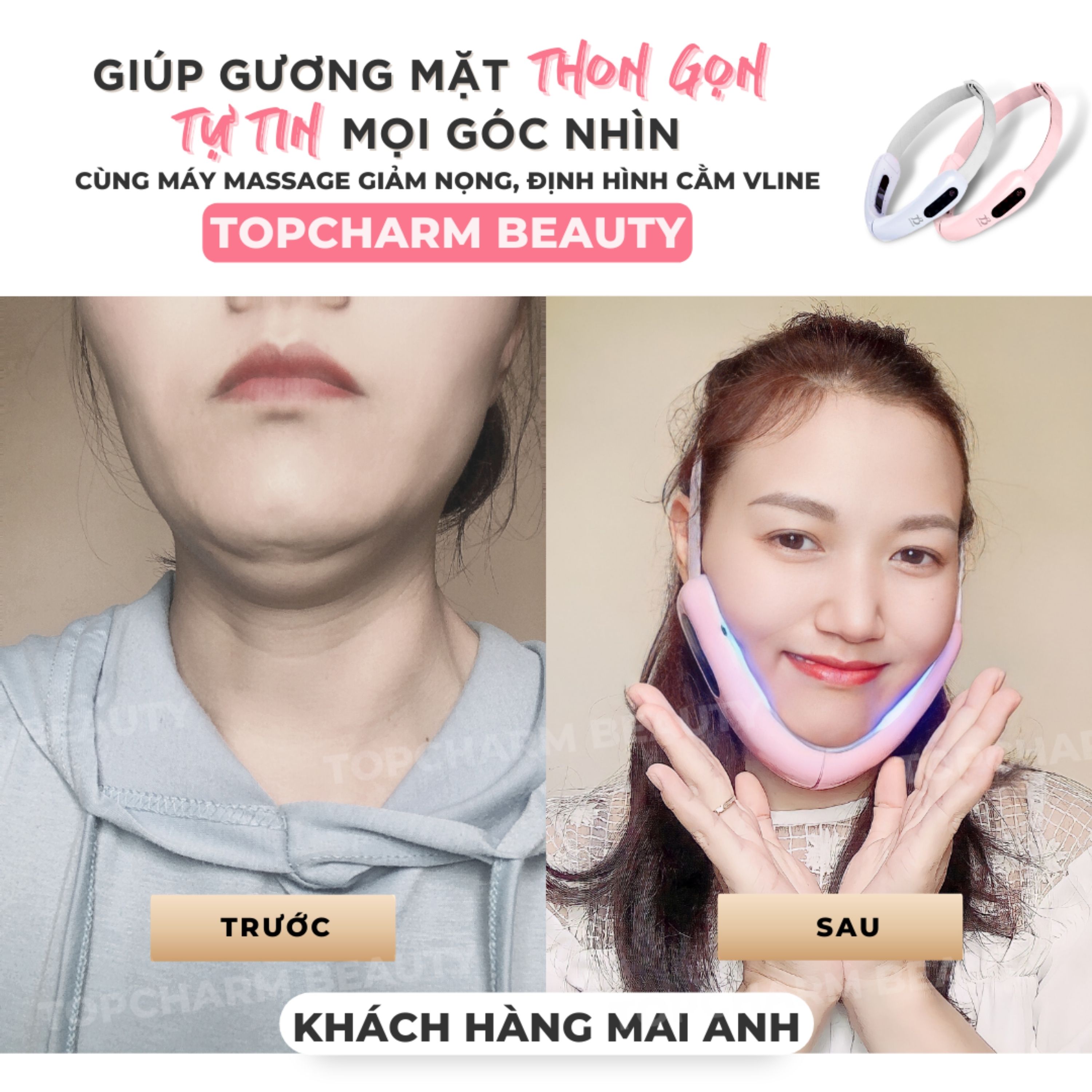 Máy nâng cơ trẻ hoá da giúp thon gọn tạo cằm V-Line TOPCHARM