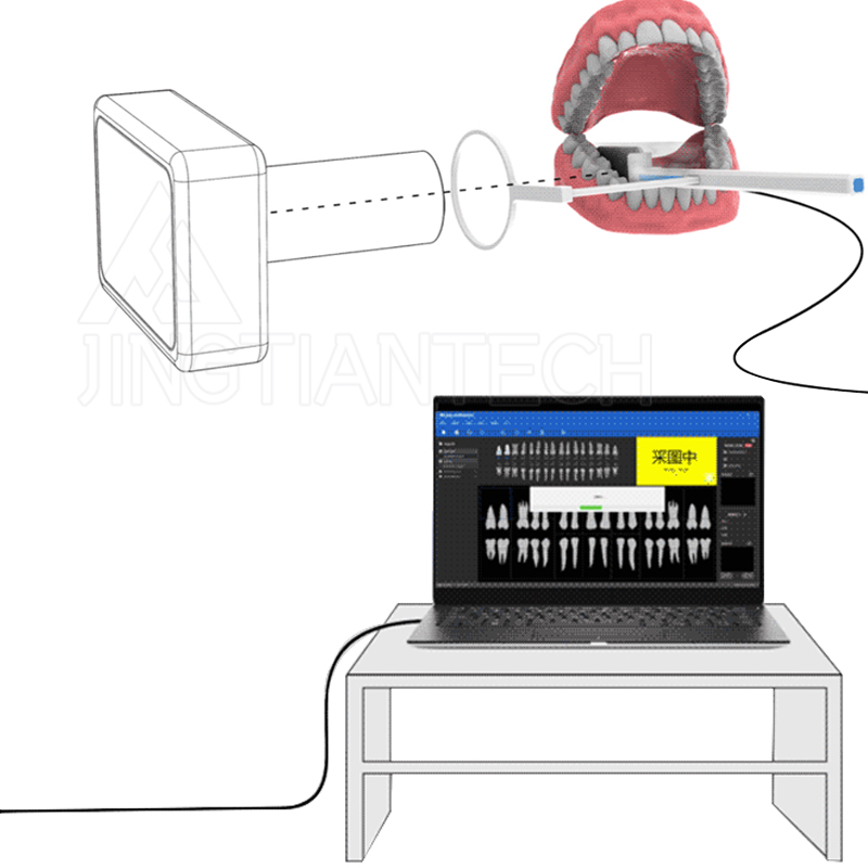 JIN GT Nha khoa Hệ thống chụp X-Quang nha khoa Hệ thống chụp X-quang kỹ thuật số nội khoa Cảm biến kích thước hình ảnh Cảm biến hình ảnh cho Phòng khám thú y Phòng khám nha khoa