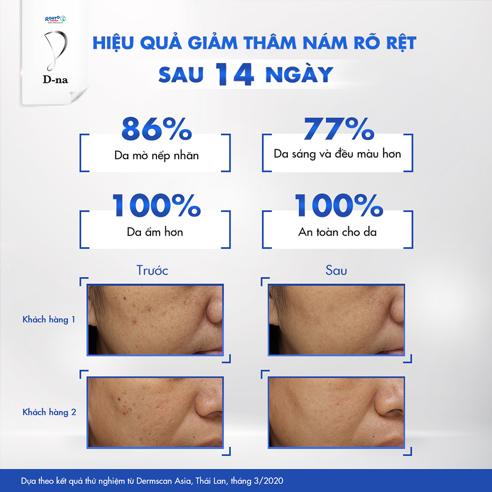 Kem dưỡng trắng toàn diện D-na Ultimate Whitening Cream