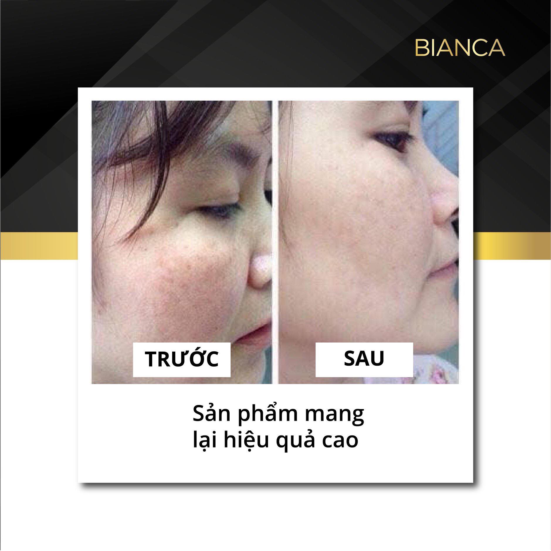 Kem dưỡng trắng da mặt Bianca - Extreme Tone Up Face Cream Bianca