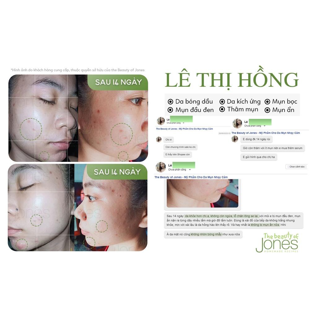 Combo làm sạch chuyên sâu The Beauty of Jones, Bộ kit sample 4 trong 1