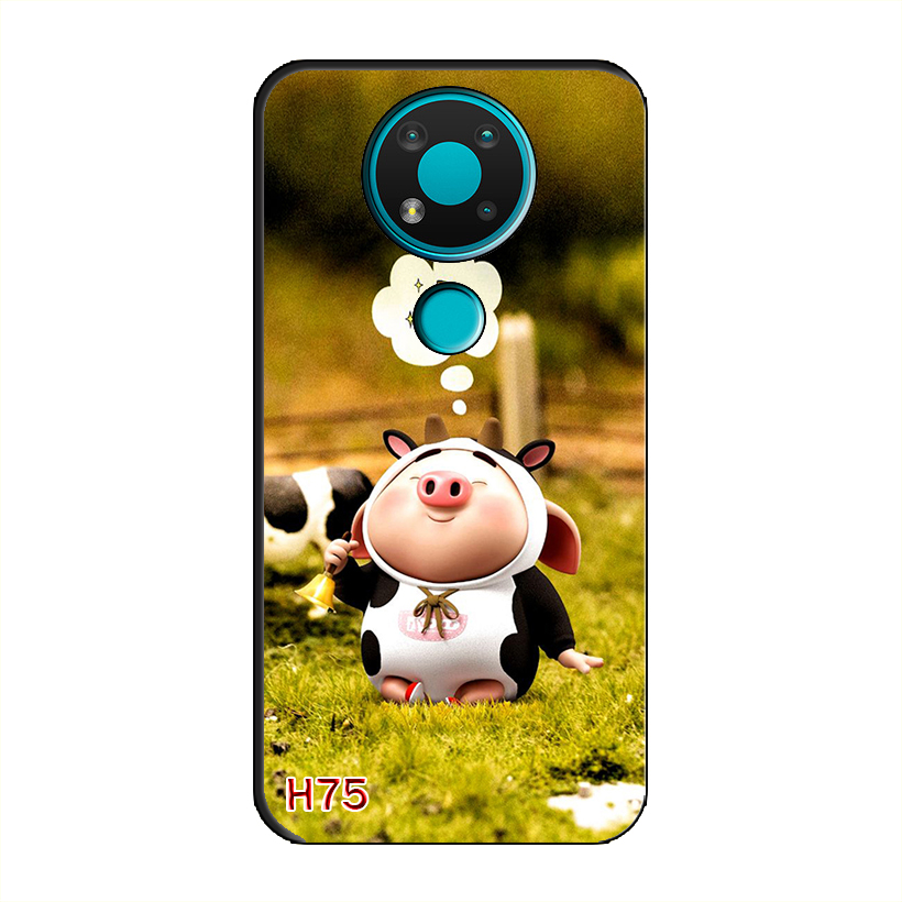 Ốp Dẻo Dành Cho NOKIA 3.4