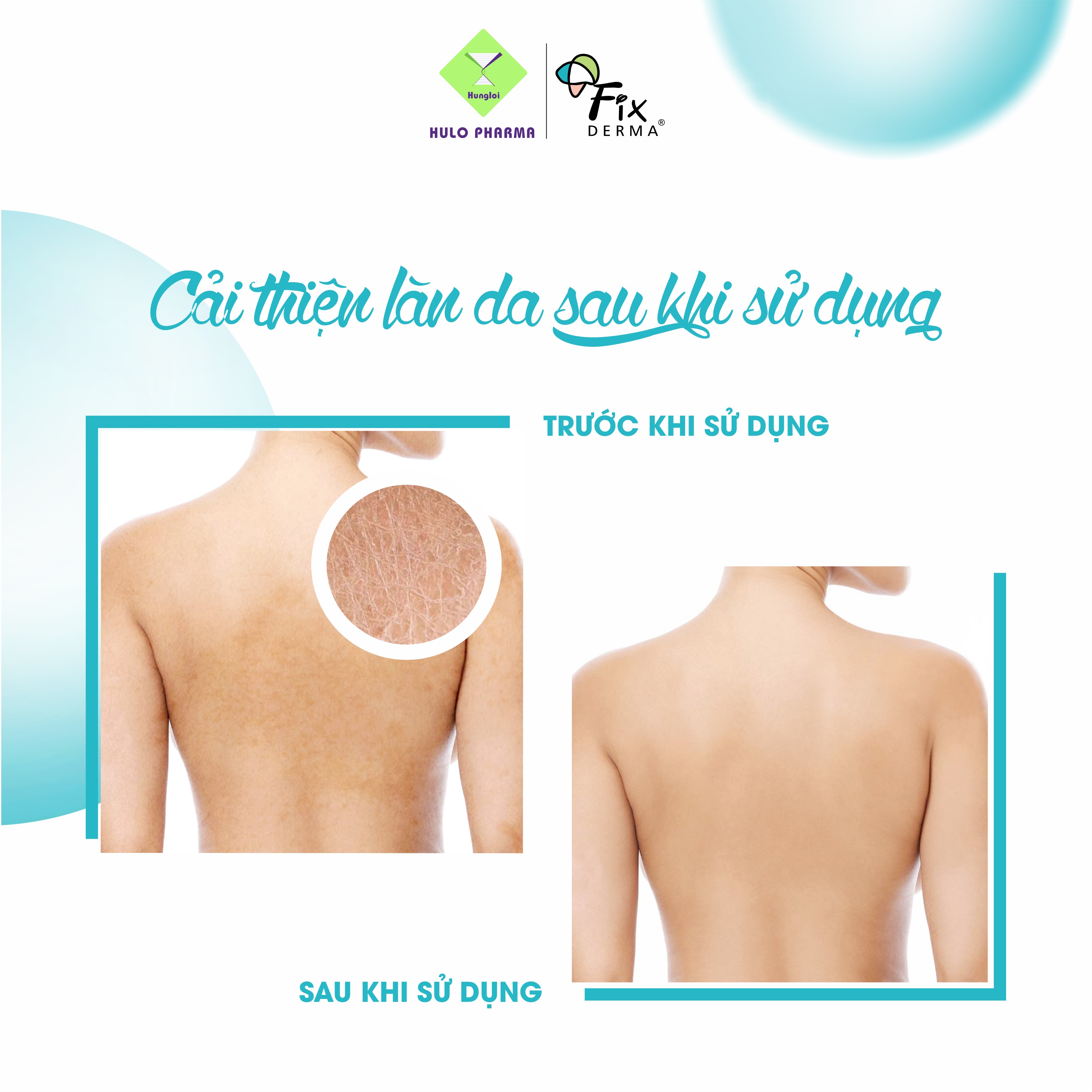 Kem giữ ẩm Fixderma Moisturizing Cream (60g)