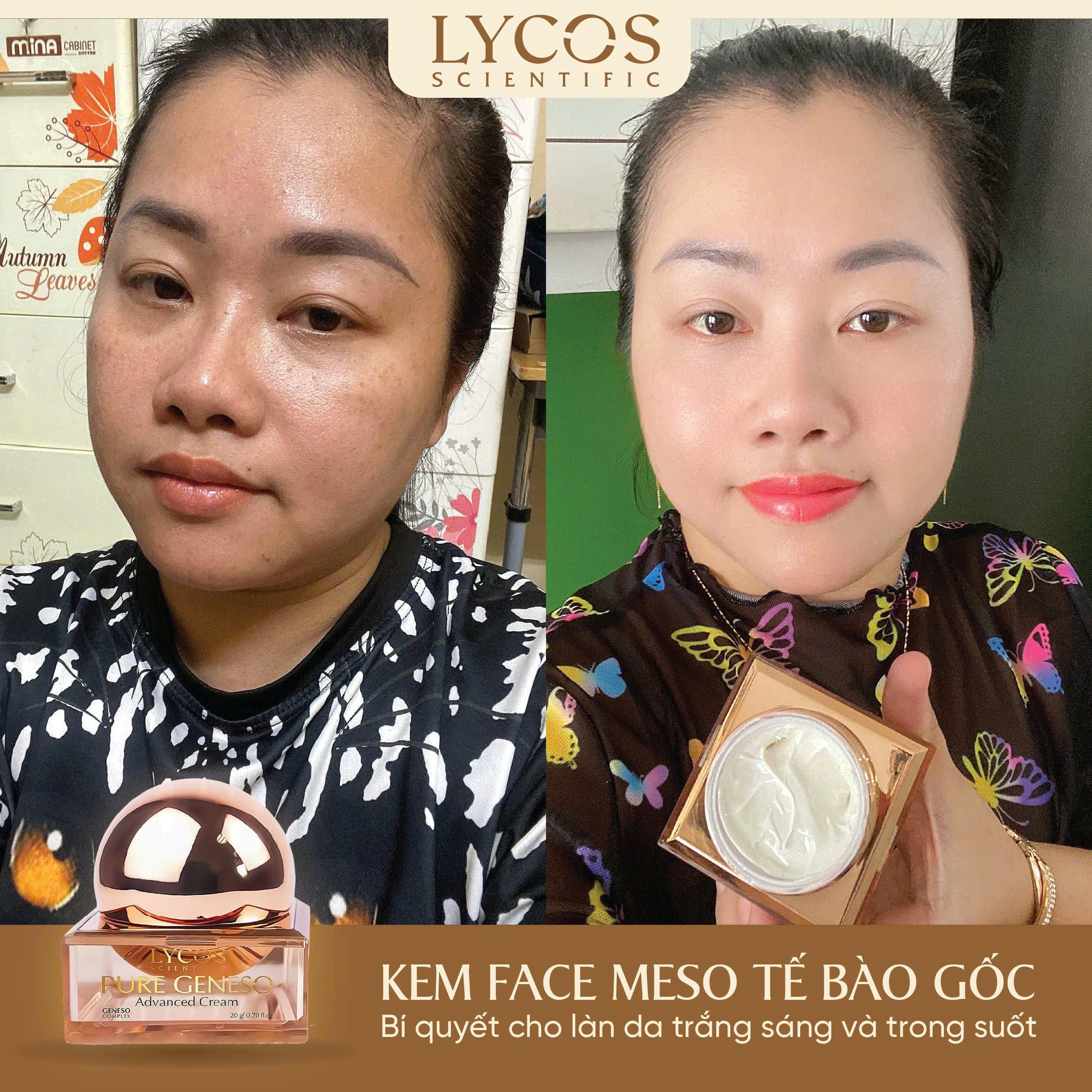 [MUA 1 ĐƯỢC 3] Kem Face Meso Tế Bào Gốc Pure Geneso Advanced Cream Lycos 20g: Sáng mịn, bật tone, giúp da căng mướt mịn màng ngay sau khi sử dụng