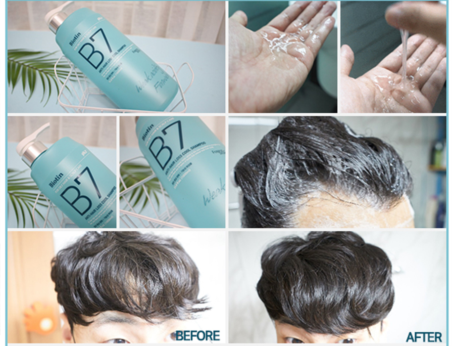 Dầu gội xả thảo dược bạc hà sạch da đầu giảm gàu, ngăn rụng tóc Biotin Anti- Hair Loss Cool Shampoo