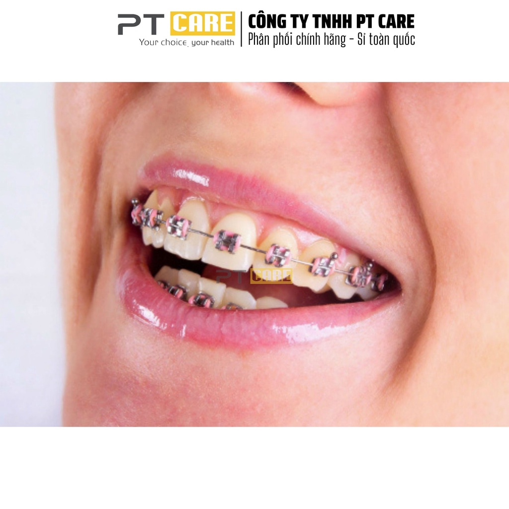 PT CARE | 10 thanh chun màu mắc cài thun đơn, tại chỗ, niềng răng, chỉnh nha