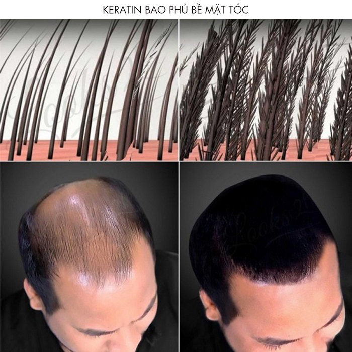 Bột phủ làm dày tóc Rene Hair Black Color (Đen) 28g