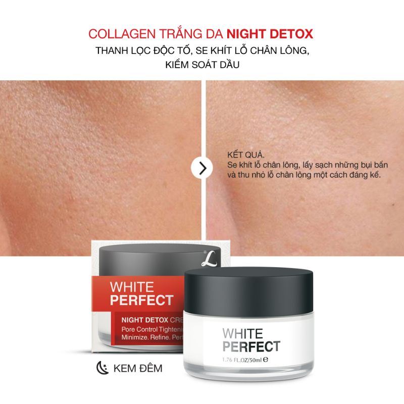 Collagen White Perfect Dưỡng Trắng Thanh Lọc Độc Tố, Se Khít Chân Lông 50ml cho Nam TẶNG Gel Vệ Sinh Vùng Kín Nam 100ml LANGCE