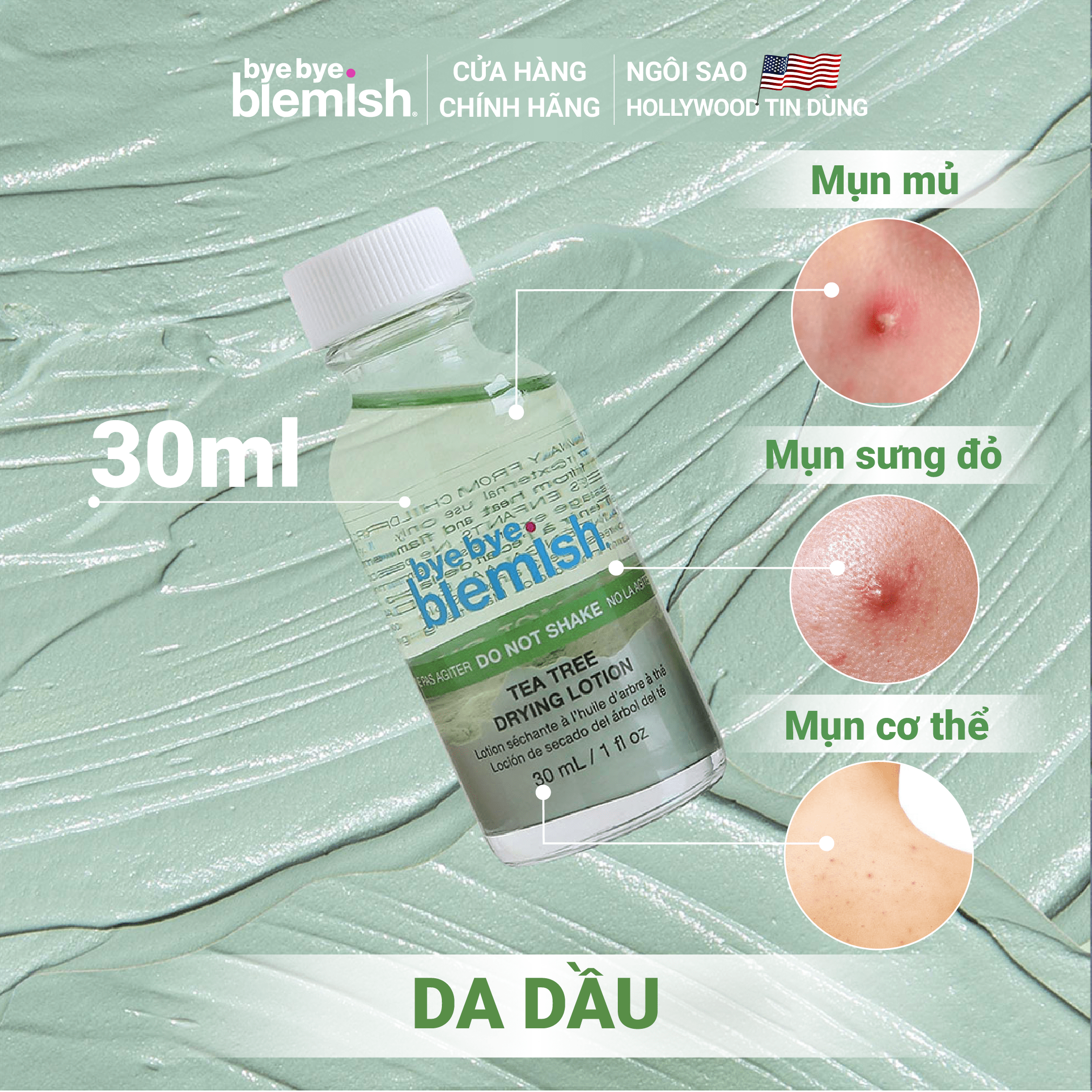 Chấm mụn Tràm Trà giảm mụn nhanh sau 1 đêm dành cho da mụn sưng viêm Bye Bye Blemish Tea Tree Drying Lotion 30ml