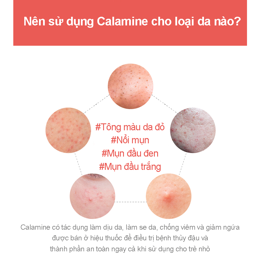 Nước hoa hồng Pour La Peau Calamine Skin Relief Toner