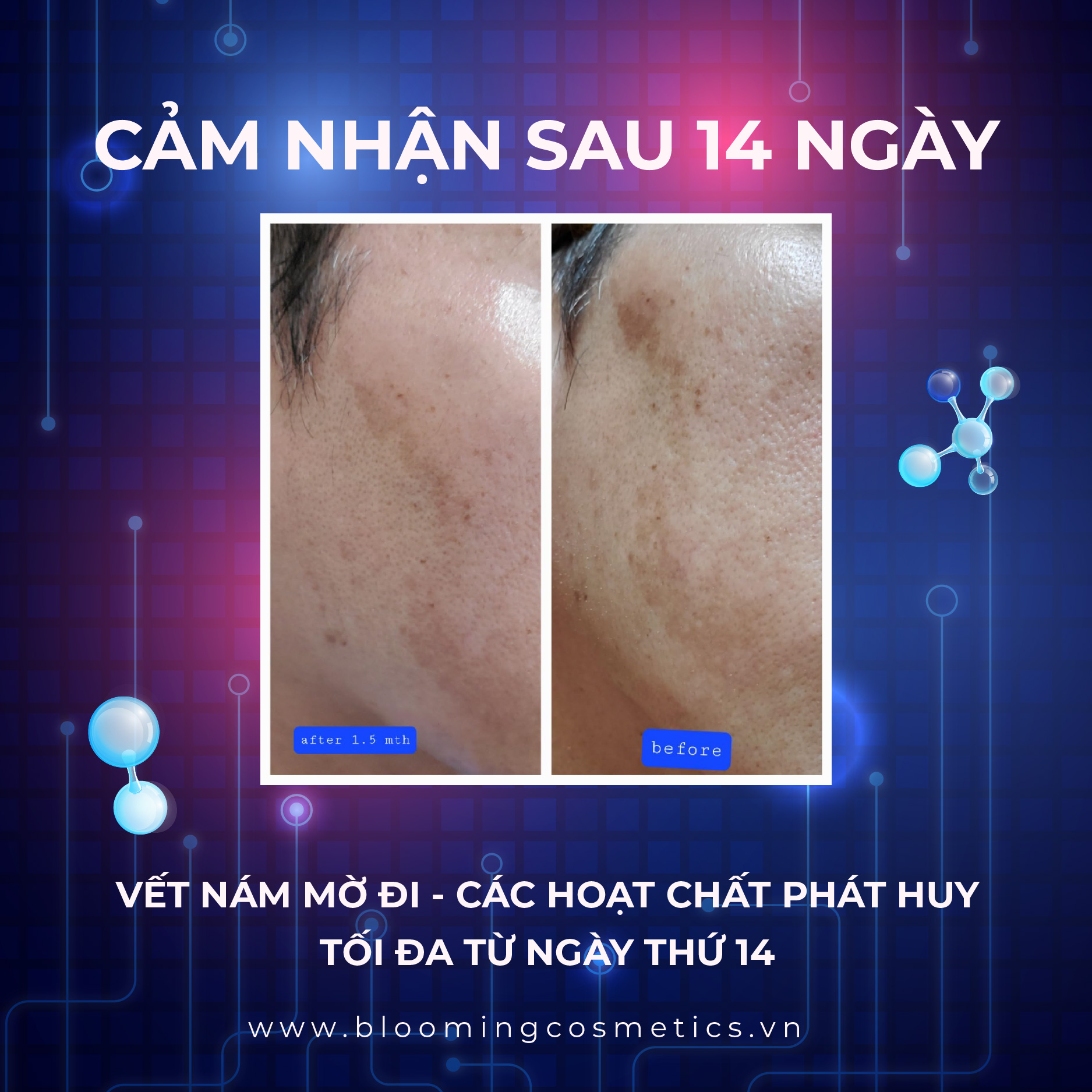 Serum dưỡng trắng da, mờ nám vượt trội Dominas Dark Spot Treatment 50ml