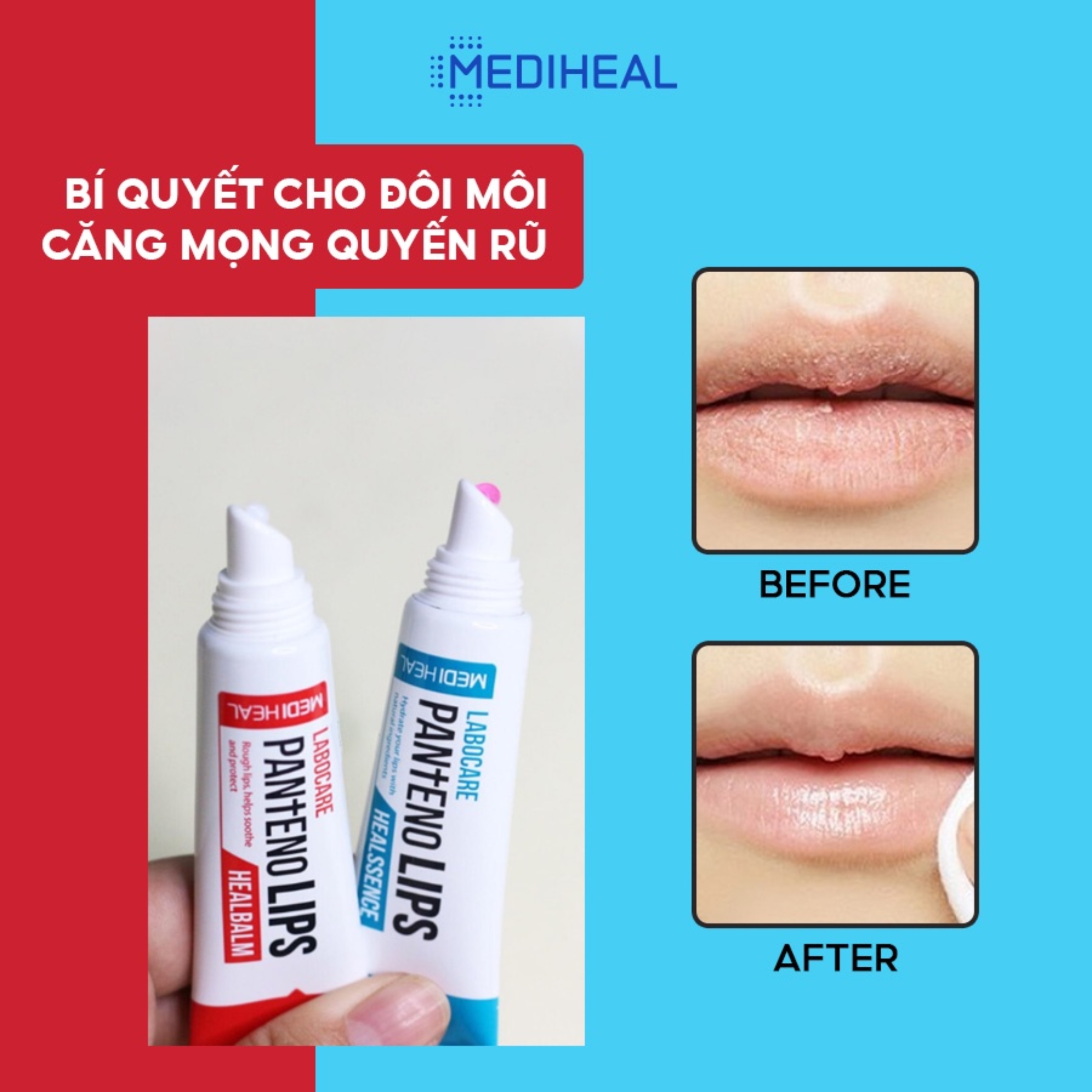 Combo 2 Son Dưỡng Môi Mediheal Labocare Pantenolips Xanh Và Đỏ Làm Mềm Môi 10ml