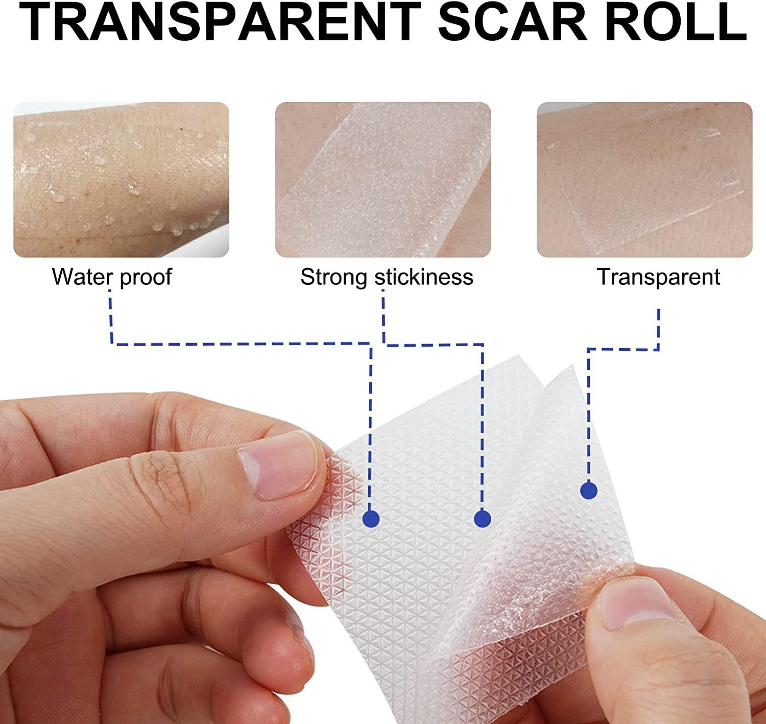Silicone sẹo cho các vết sẹo gây ra bởi mổ lấy thai, phẫu thuật, bỏng, sẹo, mụn trứng cá, vv Không có thuốc Silicone Scar Roller