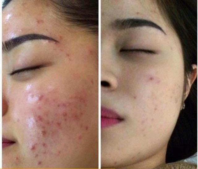 Mặt Nạ Cấp Ẩm, Làm Dịu Da, Dưỡng Trắng Da SOOTHING RECOVERY Awakethe Cell Hàn Quốc - Mặt nạ Phục Hồi