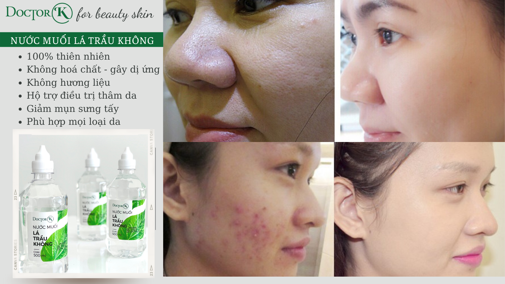 Nước muối sinh lý lá trầu không Doctor K - Trị viêm loét, hôi miệng, mẫn ngứa - an tâm sử dụng